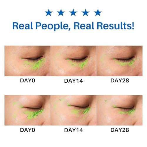 Caffeine Eye Cream, Under Eye Cream for Dark Circles, Puffiness & Puffy Bags, Wrinkles Fine Lines, Eye Roller Serum with 360° Massage Ball for Women and Men - 0.7 fl. oz