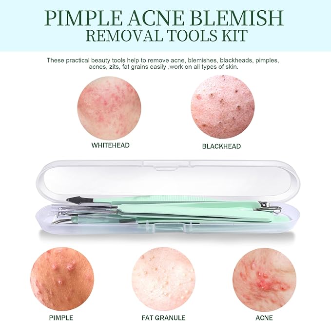 Teenitor 7 Pcs Surgical Grade Blackhead Remover Tools and Pimple Popper Tool Kit, Ingrown Hair Tweezers, Blackhead Tweezers, Precision Tweezers, Pimple Extractor, Light Green