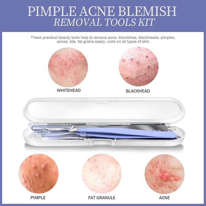 Teenitor Blackhead Remover Tools, Pimple Popper Tool Kit, Ingrown Hair Tweezers, Blackhead Extractor Pimple Extractor Ingrown Hair Removal Kit, Black Head Remover for Face