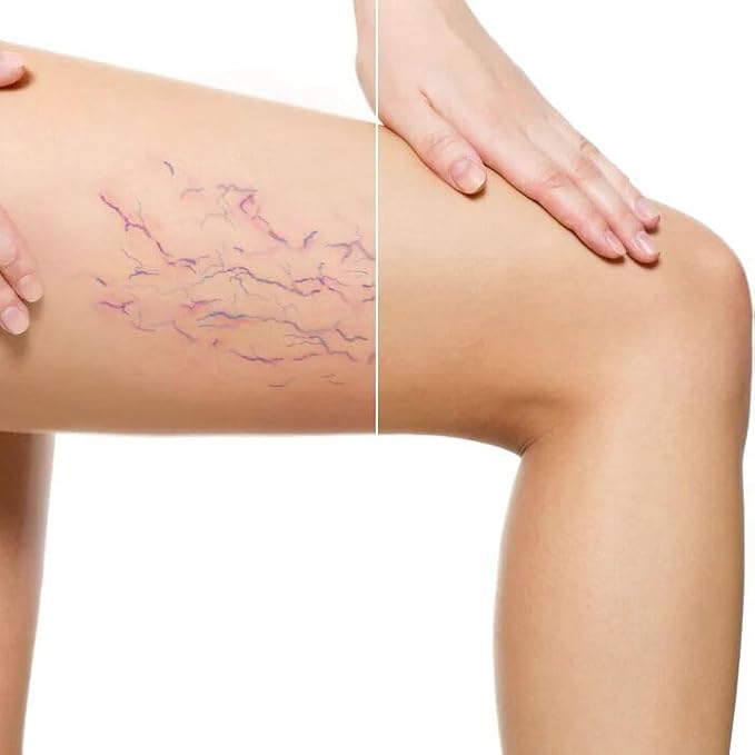 LUMINESS Airbrush Body Coverage - Tattoo Cover Up Makeup - Full Coverage Foundation for Face & Body - Water-Resistant, Long-Wear, Natural Radiant Finish, Light Tan