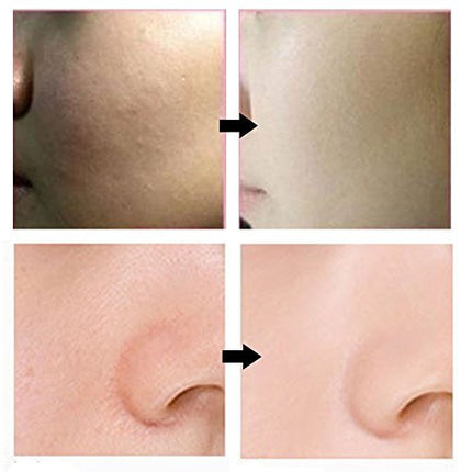 Bergamo] Magic Snail BB Cream 50ml /Intense Care Wrinkle Care Sunblock/Korean Cosmetics