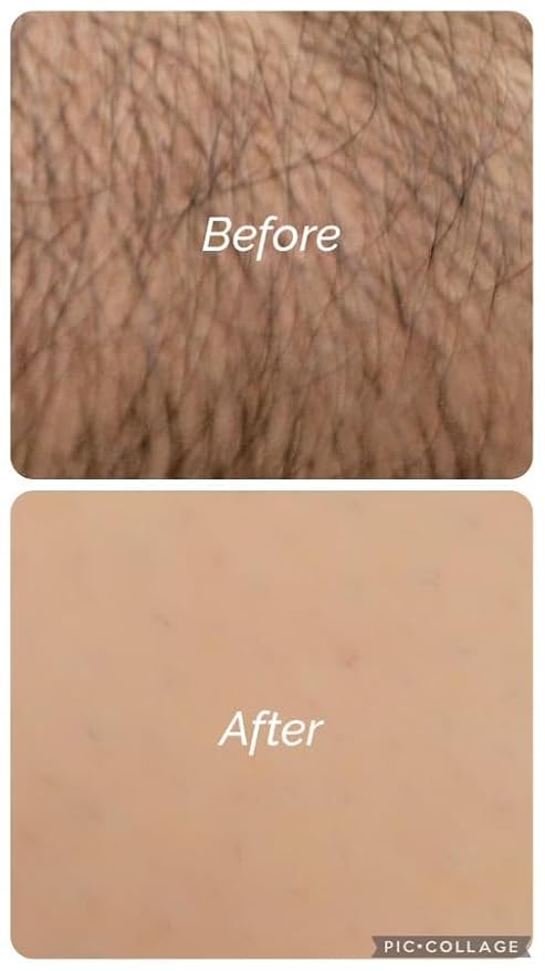 ARABESKS Eyebrow & Face Razors for Women – Dermaplaning Tool with Safety Guard, Eco-Friendly Handle – Peach Fuzz Remover, 3-Pack