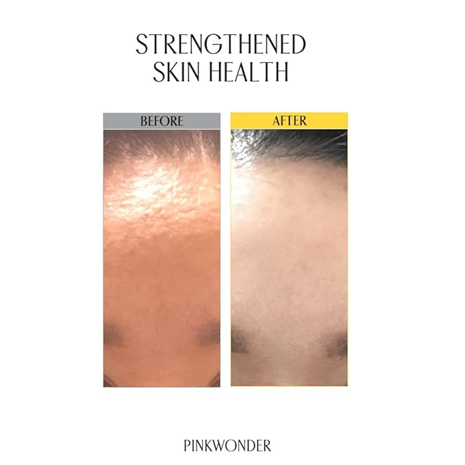 PINKWONDER Jojoba Barrier Plus Cream 1.69oz(50ml), 24HR Long Lasting Moisturizier Face Cream, Jojoba Oil and Hyaluronic Acid for Dry Skin, Korean Skin Care