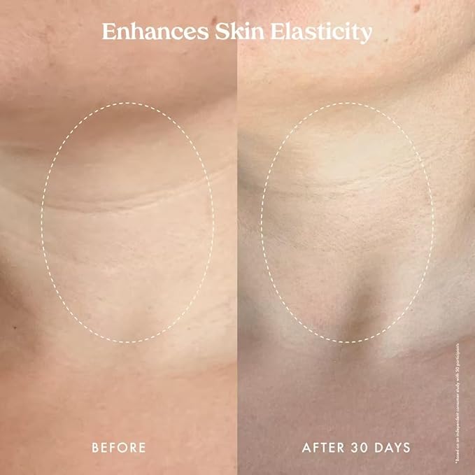 Kopari Ultra Restore Firming Body Serum with Dual Peptide Complex, Deeply Hydrates, Improves Skin Tone & Texture, Firms & Enhances Elasticity, 5 oz