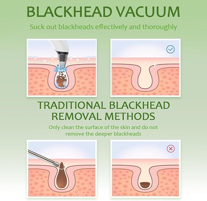 Blackhead Remover Pore Vacuum - Facial Pore Cleaner with 3 Adjustable Suction Levels, 4 Blackhead Removal Tools, Electric Acne Extractor Tool for Women & Men