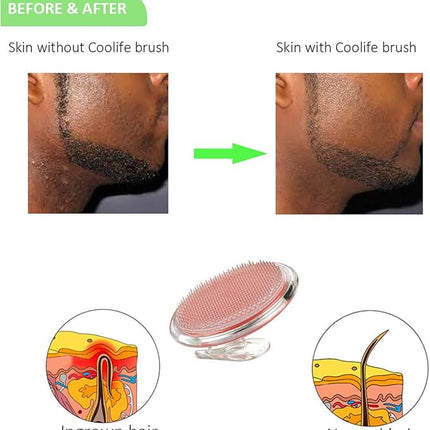 Coolife Ingrown Hair Remover, Razor Bumps Keratosis Pilaris KP Repair Brush, After Shave or Wax Exfoliator for Face, Bikini, Legs, Arms - Fascia, Cellulite Blast Massager Tool for Men and Women