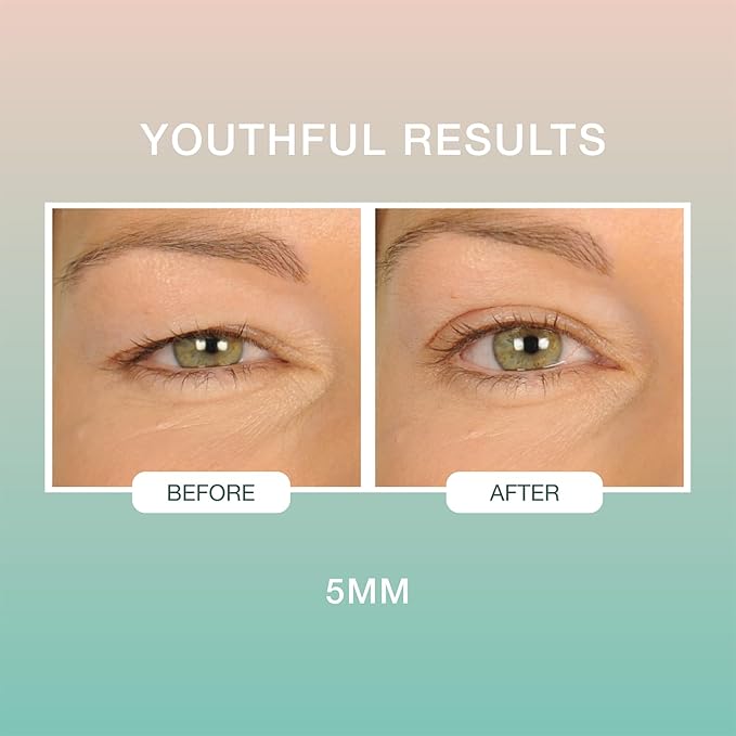 Contours Rx Lids by Design – 5mm Transparent Eyelid Lift Strips for Casual Mild to Moderate Hooded Lids – Medical-Grade, Anti-Aging Eyelid Tape – 80 Count