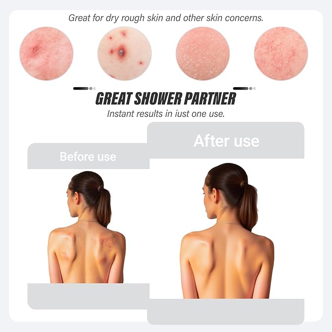 Inmorven Exfoliating Back Scrubber with Handles, Nylon Back Exfoliator, Two Sides Stretchable Pull Strap Shower Deep Cleans Skin Massages Invigorating Blood Circulation for Women Men Body (Pink)