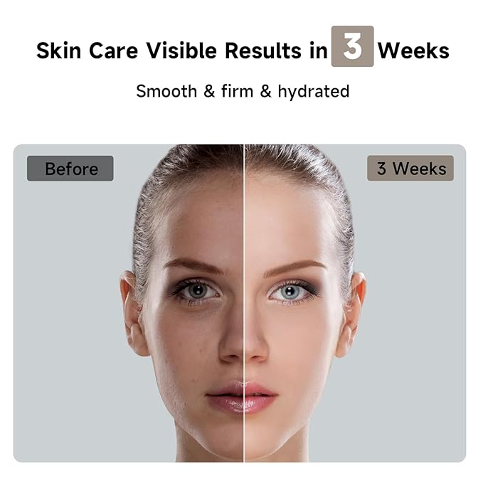 JOVS Laser Hair Removal, 37°F Painless Hair Removal Device with Sapphire Ice-Cooling, 3 in 1 Hair Removal & Skin Rejuvenation for Women and Men, 8 Modes Skin Care for Whole Body, Touch Screen