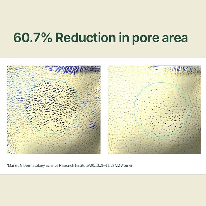 Pyunkang Yul PKY Calming Line Gift Box Set - Korean Facial Skin Care Essential for Daily Moisturizing, Safe on Acne Prone & Sensitive Skin, Vegan & Cruelty Free