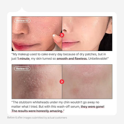 Parnell AHA 9.12% Omija Ceramic Wash-Off Serum | 1-Minute Face Exfoliation for Sebum Control & Smooth Texture | PHA BHA LHA Vitamin C K-Care (1.01 fl oz)