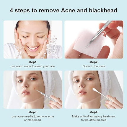 Professional Blackhead and Blemish Remover -Pimple Comedone Removal 2-in-1 Extractor Tool -by La Chat (2 Packs)