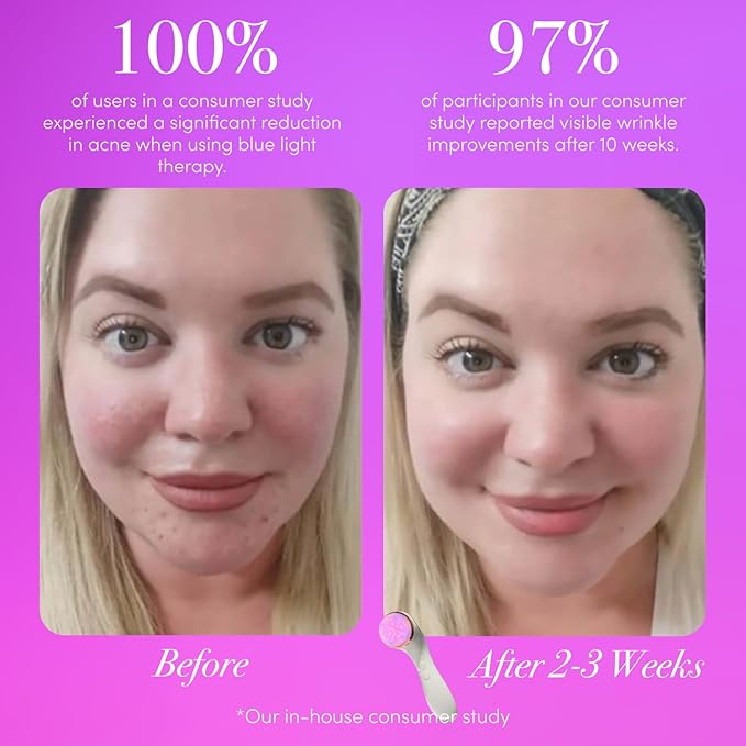 reVive Light Therapy LED Technologies | Lux Collection Soniqué Sonic | Facial Cleansing Brush | Red & Blue Light Therapy | Reduces Appearance | Acne & Wrinkles