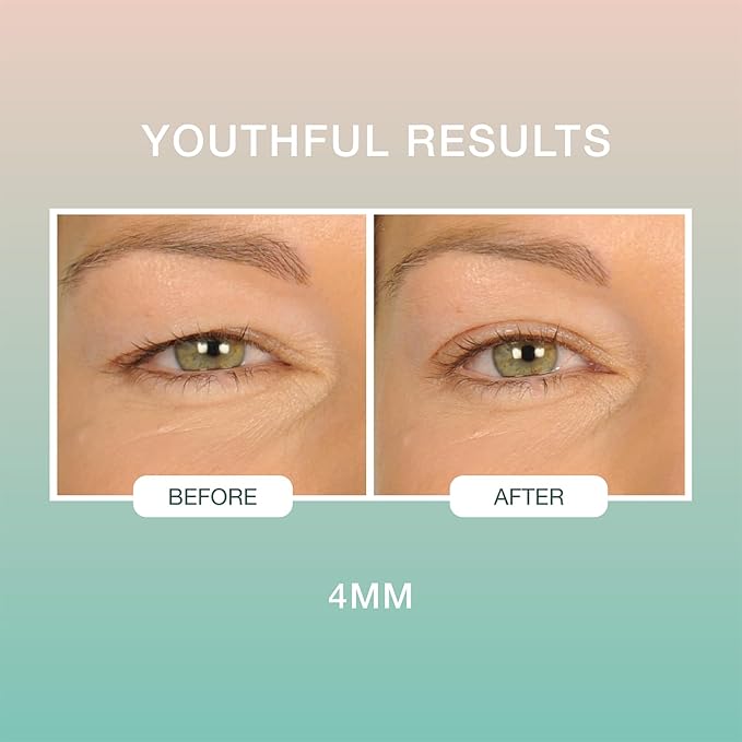 Contours Rx Lids by Design – 4mm Invisible Eyelid Lift Strips for Slight Hooded, Droopy & Heavy Lids – Medical-Grade, Non-Surgical Eye Lift Tape – 80 Count