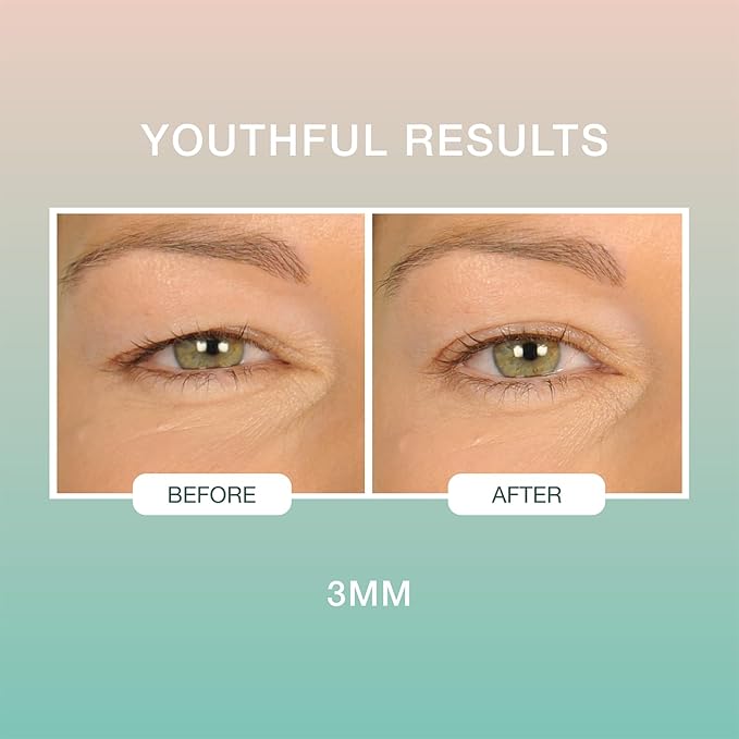 Contours Rx Lids by Design – 3mm Invisible Eyelid Lift Strips for Slight Hooded, Droopy & Heavy Lids – Medical-Grade, Non-Surgical Eye Lift Tape – 80 Count