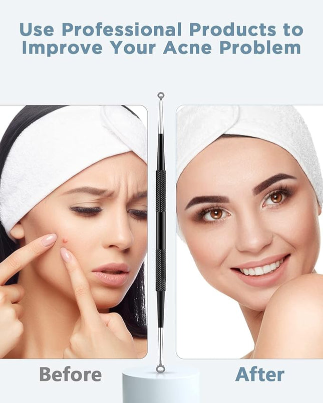 TAYTHI Blackhead Remover Tool, Pimple Popper Tool Kit, Blackhead Extractor Tool for Face, Extractor Tool for Comedone Zit Acne Whitehead Blemish, Stainless Steel Extraction Tools