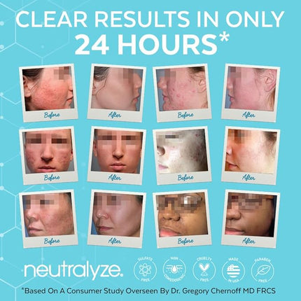Neutralyze Moderate To Severe Acne Treatment Kit 2.0 (Clearing Serum & Synergyzer)