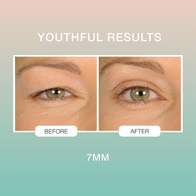 Contours Rx Lids by Design – 7mm Eyelid Lift Strips for Dramatic Lift on Hooded, Droopy Eyelids – Medical-Grade, Anti-Aging, Non-Surgical Eye Tape – 80 Count