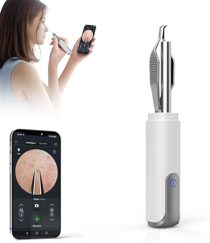 Blackhead Removal Tweezer with 1080p Camera, Ultimate Precision: Blackhead Removal with Camera - Perfect for Delicate Tasks! - - Eyebrow Tweezer, Pull White Hair (White)