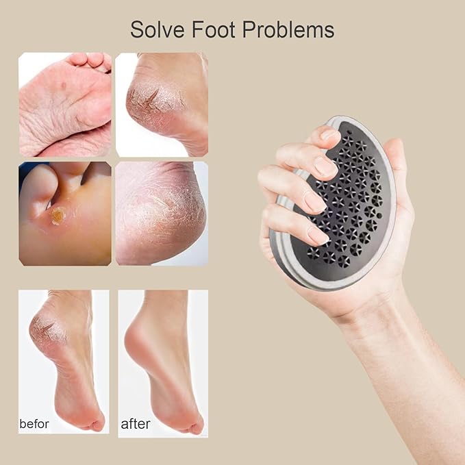 Professional Crystal Hair Remover - Nano Glass Epilator & Exfoliator 2-in-1 | Chemical-Free & Reusable | Painless Alternative to Waxing/Shaving