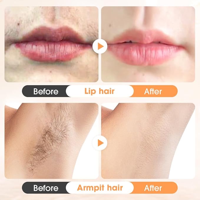 Hair Removal Cream for Women,2025 New Gentle Facial Hair Removal Cream With Scraper, Painless Hairs Removers for Body Face Lips (1)