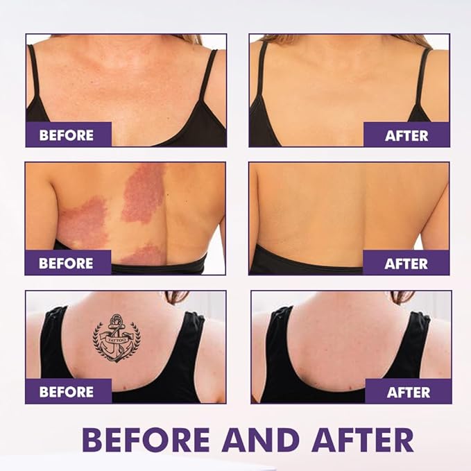 Body Coverage Perfector, Waterproof Leg and Body Makeup, Tattoo Cover Up, Moisturizing