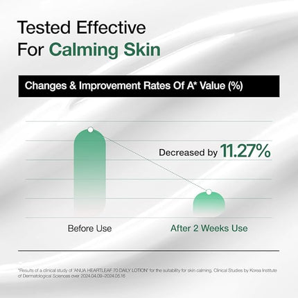 Anua Heartleaf Daily Lotion, Face Moisturizer with Hyaluronic Acid for Sensitive Skin, Lightweight, Korean Skin Care (200ml, 6.76 fl.oz.)