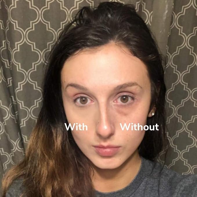 Wide Awake Dark Circle Concealer for Sensitive Skin – Lightweight Mineral Corrector Neutralizes Under Eye Darkness – Cruelty Free, Clean Makeup, Long Lasting Natural Coverage - 5g