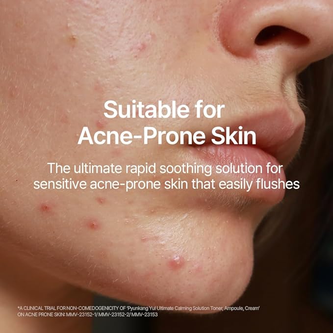 Pyunkang Yul PKY Ultimate Line Skincare Set, Mother's day gift for mom, Calming Solution Toner, Ampoule & Cream, Traditional Korean-Style Packaging, Zero-Irritation (3-item set)