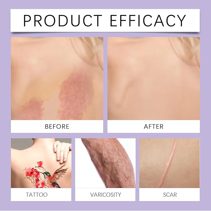 All Over Complexion Perfector, Body Coverage Perfector, Tattoo Cover-up Makeup, Transfer-Resistant Body Makeup, Long Last Body Foundation(Dark Brown)