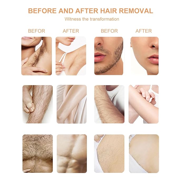 YOUNG VISION Hard Wax Beads for Hair Removal, 2.2lbs 1000g Refill Waxing Beads for Sensitive Skin Women, Face, Brazilian, Bikini, Body, Soft and Painless Waxing Beans, 10 Packs, Multi Color