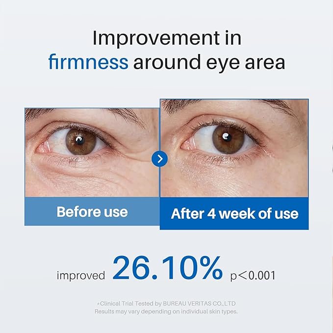 Caffeine Eye Cream, Under Eye Cream for Dark Circles, Puffiness & Puffy Bags, Wrinkles Fine Lines, Eye Roller Serum with 360° Massage Ball for Women and Men - 0.7 fl. oz