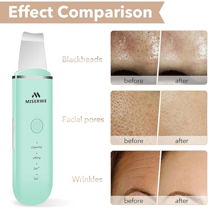 Skin Scrubber Face Skin Spatula Facial Scrubber Spatula Pore Cleaner with 4 Modes (Green)