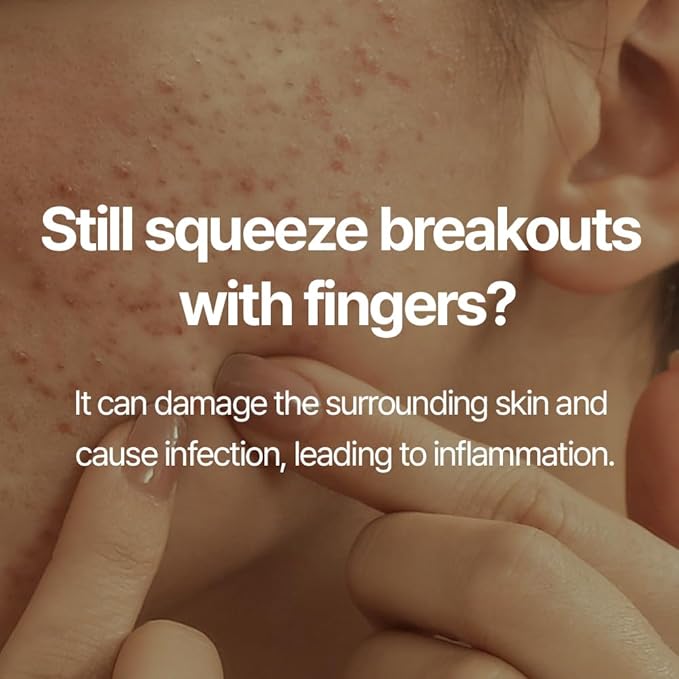 Pyunkang Yul PKY Zit Extractor Set, Tin Case Included, Extractor Tools for Zit Removal on Face, Stainless Steel Slip Free Use (3 Piece Kit)