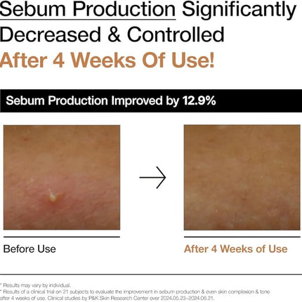 Anua Rice 70 Glow Milky Toner, Glass & Dewy Skin, Hydrating & Barrier Care, Rice Water, Niacinamide, Ceramides, All Skin Types, Fragrance-Free, Non Comedogenic, Korean Skincare, 8.45fl.oz