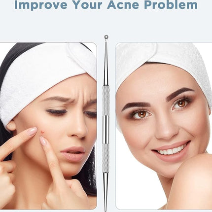 BESTOPE Blackhead Remover Blackhead Removal Pimple Comedone Extractor Tool - Treatment for Blemish Whitehead Popping Zit Removing with Metal Case (Silver)