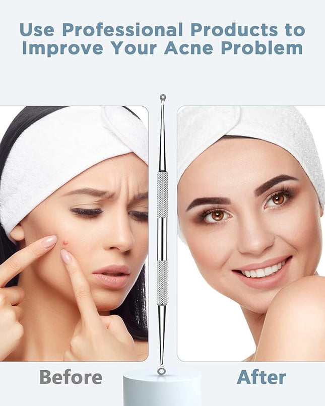 BESTOPE Blackhead Remover Blackhead Removal Pimple Comedone Extractor Tool - Treatment for Blemish Whitehead Popping Zit Removing with Metal Case (Silver)