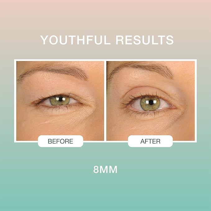 Contours Rx Lids by Design – 8mm Eyelid Lift Strips for Dramatic Lift on Hooded, Droopy Eyelids – Medical-Grade, Anti-Aging, Non-Surgical Eye Tape – 80 Count