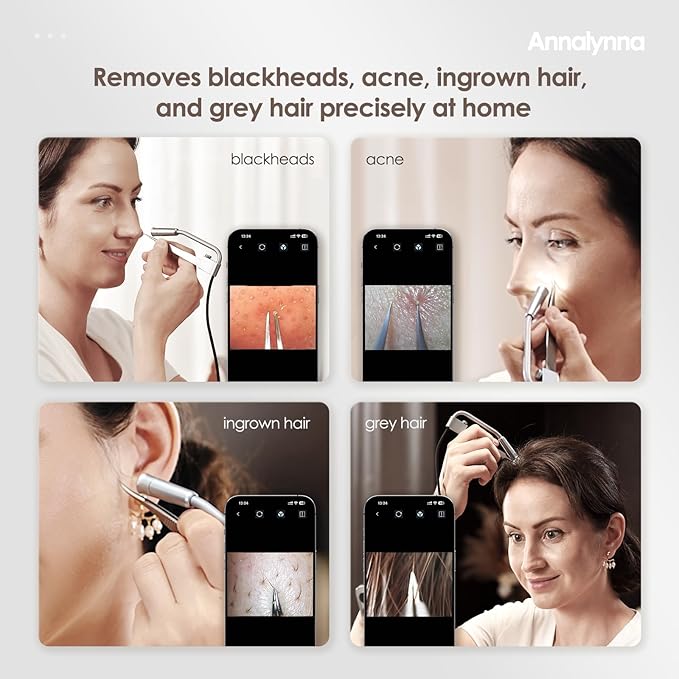 Visual Blackhead Remover Tweezers with Camera - 20x Magnification Pimple Popper Tweezers, with 2* Curved Comedone Extractor, Professional Pimple Acne Blemish Removal Tools Kit (6 Pcs Kit)