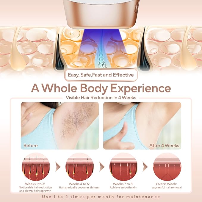 Laser Hair Removal, IPL Hair Removal for Women and Men, Hair Removal Device for Bikini Legs Armpits Arms At Home, 999,900+ Flashes Painless Effective & Long-Lasting