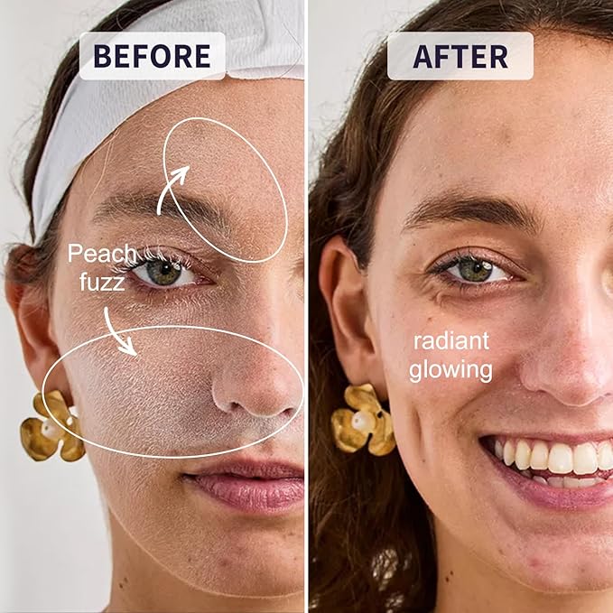 Dermaplane Razor for Women Face - Facial Razor for Women - Eyebrow & Face Razors, Exfoliating Microblades, Peach Fuzz Remover, Dermaplaning & Skin Care Tool, Travel Essentials, (12 pcs, Solar Veil)