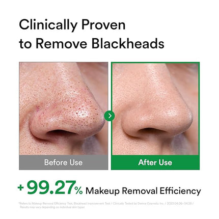 Hydrating Light Cleansing Oil for Sensitive Skin, Waterproof Makeup Remover & Blackhead Cleaner with Rice Bran Oil, Turmeric, and Centella Asiatica, Korean Skin care (205ml/6.93 fl oz)