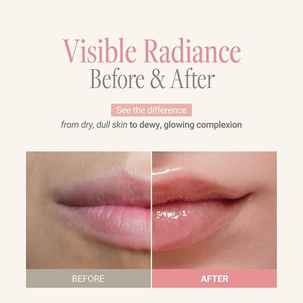 ANILLO Mellow Glow Balm - Korean Tinted Lip and Cheek Balm with Shea Butter, Herbal Essential Oil & PHA - Glossy and Vegan K Beauty Lip Moisturizer & Cheek Blush (0.18 oz)