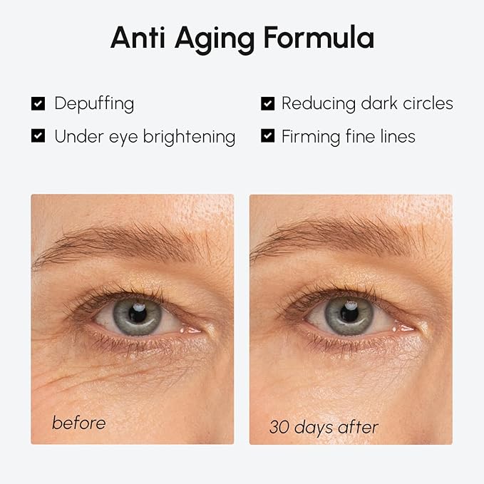 MAREE Under Eye Balm Stick Hydrating - Retinol Caffeine Under Eye Brightener Stick for Older Women - Collagen Under Eye Cream for Dark Circles & Wrinkles - Skin Care Treatment Moisturizer