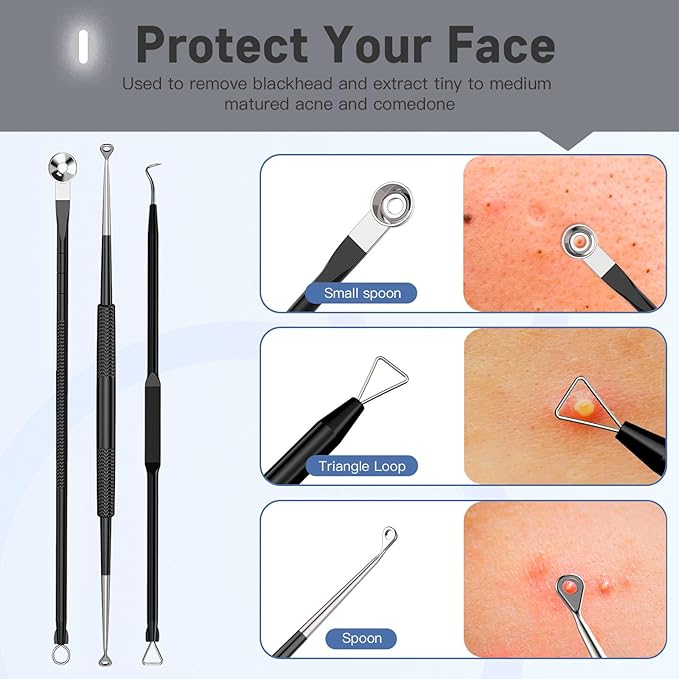 Professional Pimple Popper Tool Kit,10 PCS Blackhead Remover Tweezers,Extractor Acne Removal Kit for Easy Removal for Pimples,Comedone Extractor Tools for Removing Zit,Acne Removal Kit (Black)