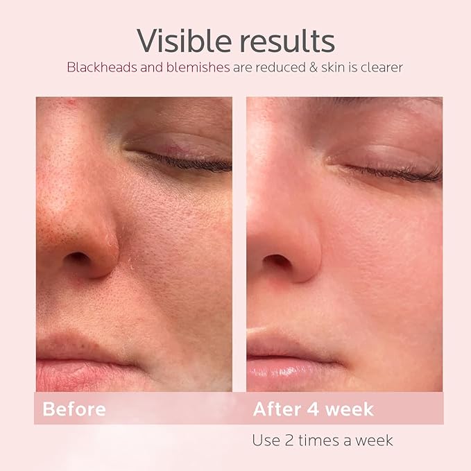 Colorfarm Facial Steamer Skin Care Set: Face Steamer Home Spa Kit Deep Cleaning Unclogs Pores with 6 Skin Care Tools - Spa Relaxing Self Care Gifts for Women (Daily Skincare Essentials Combo)