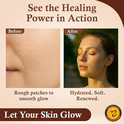 Sweet Bee Magic All In One Healing Organic Balm - Natural Skin Healing Cream, Beeswax Balm for Dry Skin, Face & Body Moisturizer - Certified Organic, All Natural Aid - 1 Jar (4oz)