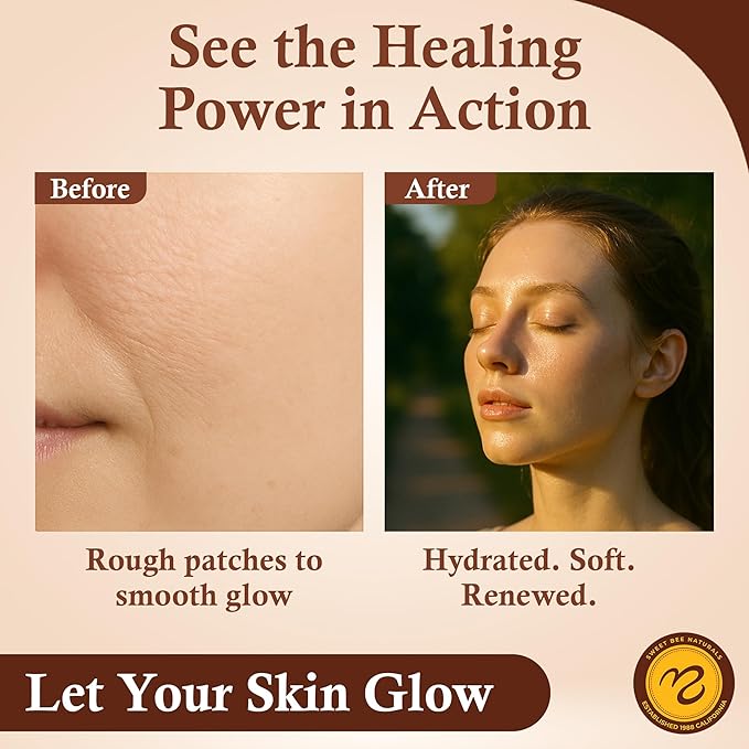 Sweet Bee Magic All In One Healing Organic Balm - Natural Skin Healing Cream, Beeswax Balm for Dry Skin, Face & Body Moisturizer - Certified Organic, All Natural Aid - (4oz Each, 24oz Total)