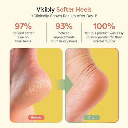 ZenToes Moisturizing Socks for Cracked Heel Treatment, Vitamin E, Olive Oil and Jojoba Oil Infused Heel Socks, Galentines Day Gifts, Self Care Gifts for Women (Fuzzy Lilac Purple, Regular)