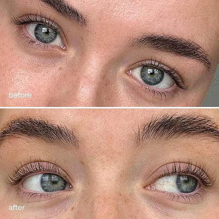 UKLASH Eyelash Complex Serum - #1 Rated Lash Serum for Longer, Stronger Lashes - Cruelty-free, Prostaglandin & Paraben-free - Recommended for All Skin Tones